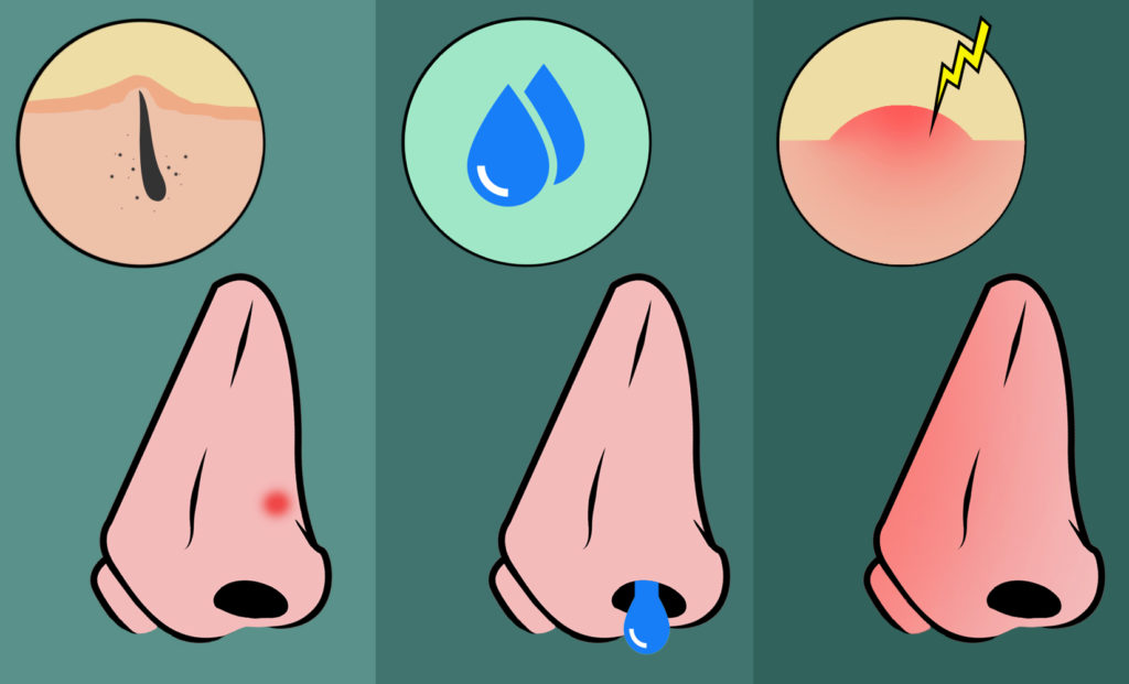 1 Do Nose Hairs Grow Back 2024 Great Guide