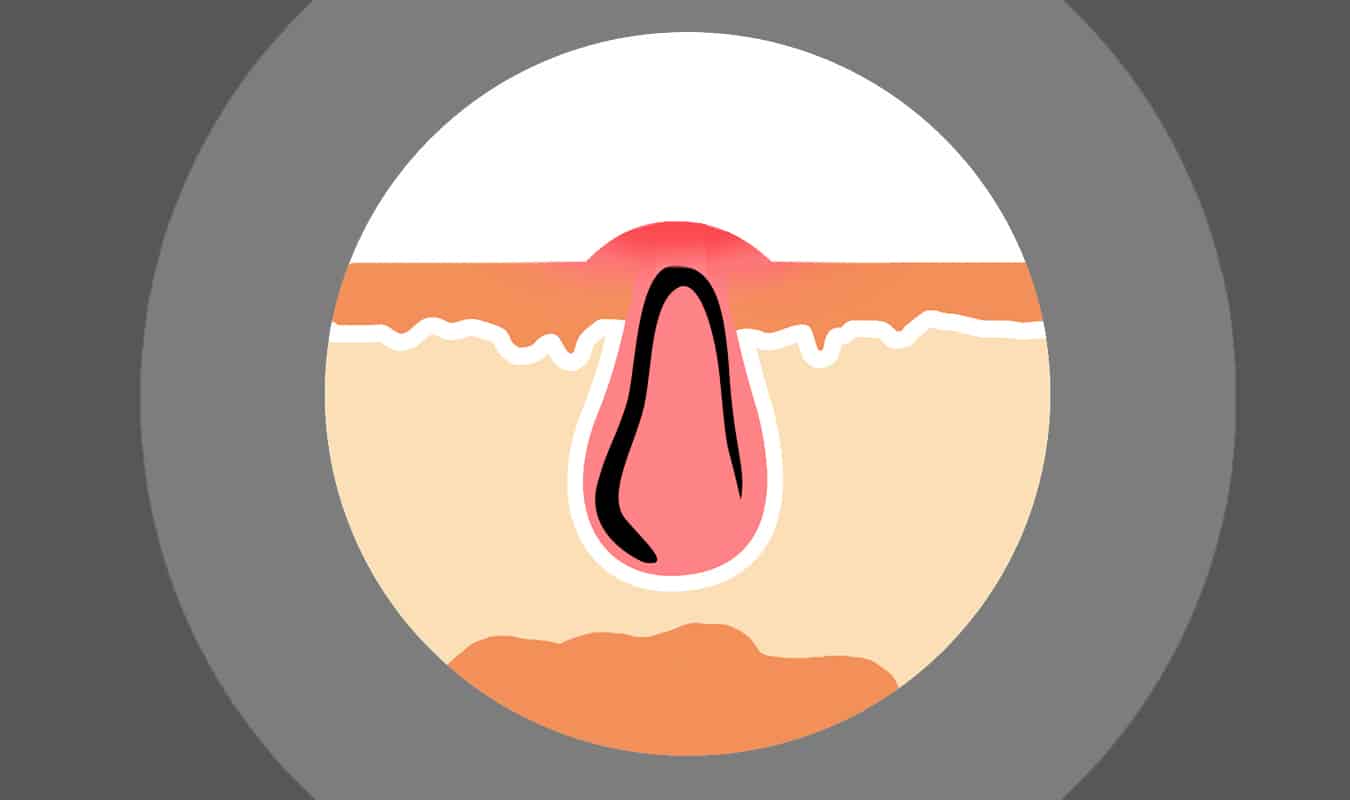 The Most Common Beard Problems in 2026 and How to Fix Them